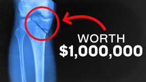 4 Surprising Injuries That Might Pay You $1,000,000