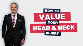 How to Value Your Head and Neck Injury After an Accident